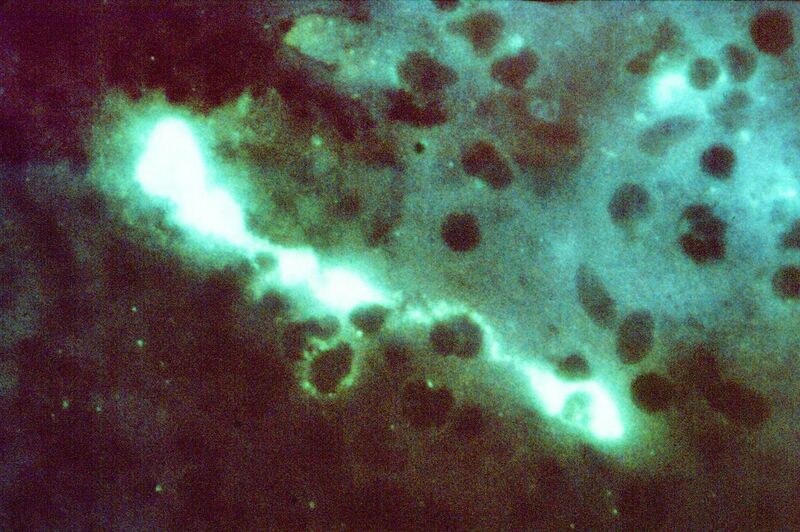 File:Chlamydophila psittaci FA stain.jpg
