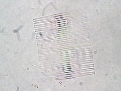 Fragilaria crotonensis.jpeg