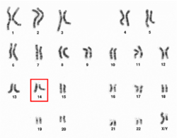 Human male karyotpe high resolution - Chromosome 14.png