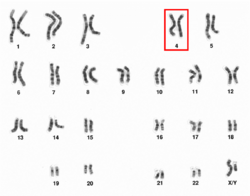 Human male karyotpe high resolution - Chromosome 4.png