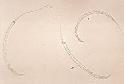 Dracunculus medinensis larvae.jpg