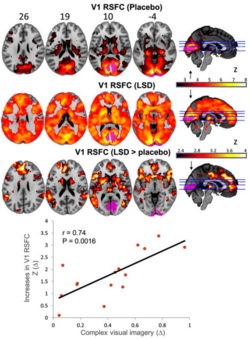 FMRI V1 RSFC LSD.png