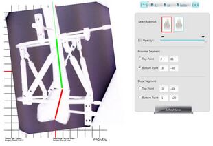 Smart Correction Radigraphic Navigation Page - 1.jpg