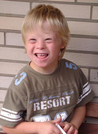 Eight year old boy with Down syndrome