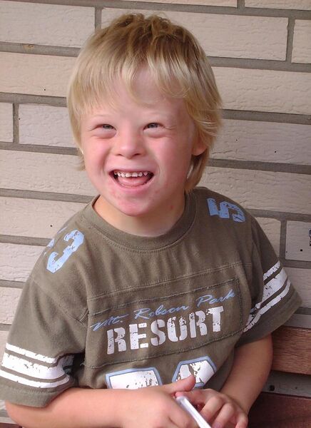 File:Boy with Down Syndrome.JPG