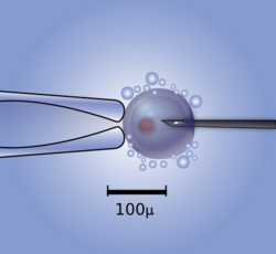 Microinjection of a human egg.svg