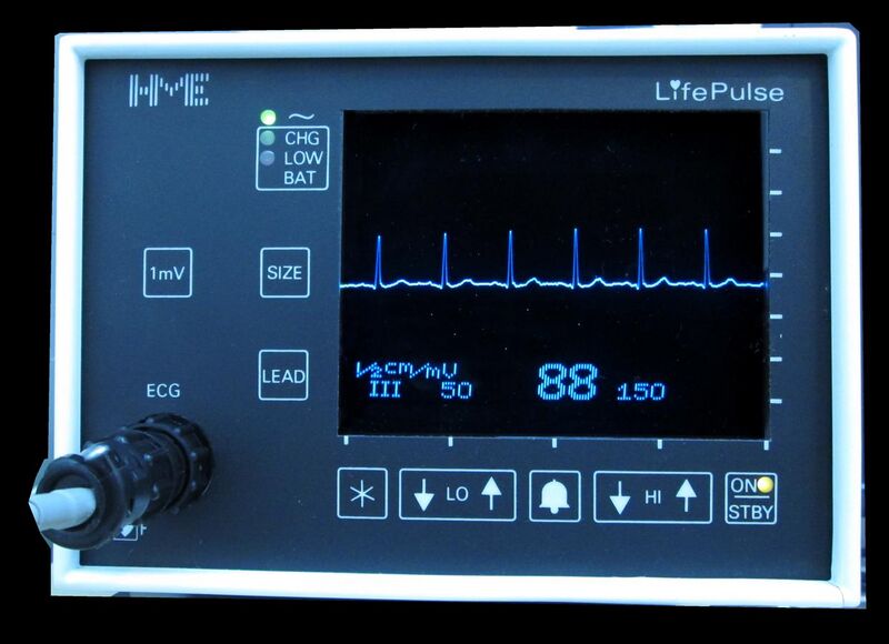 File:Normal electrocardiogram.jpg