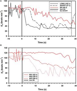 Conditioned Variation in Heart Rate During Static Breath-Holds in the Bottlenose Dolphin (Tursiops truncatus) – examples of instantaneous heart rate (ifH) responses.jpg