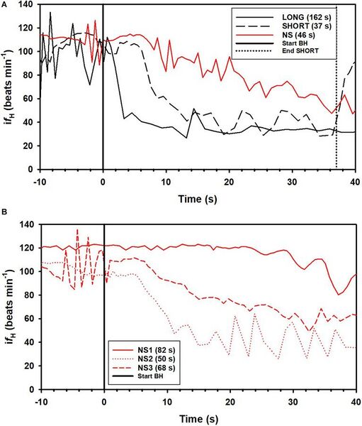 File:Conditioned Variation in Heart Rate During Static Breath-Holds in the Bottlenose Dolphin (Tursiops truncatus) – examples of instantaneous heart rate (ifH) responses.jpg
