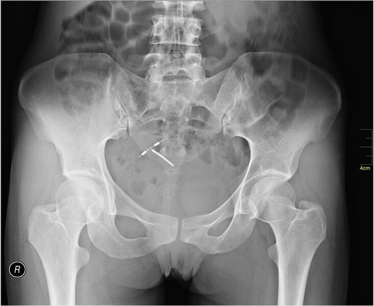 File:Medical X-Ray imaging NNZ06 nevit.jpg