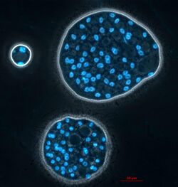 Colony of Abeoforma whisleri (Ichthyosporea) stained with Hoechst (nuclei in blue) in vivo Picture by Maria Rubio and Cristina Aresté