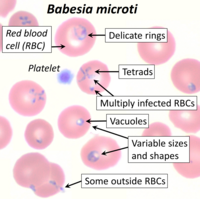 Blood smear of Babesia microti, annotated.png