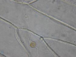 Cellulose Chytrids TVP12 005.jpg