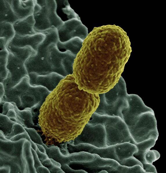 File:Klebsiella pneumoniae Bacterium (13383411493).jpg