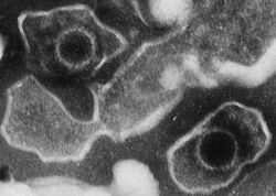 Electron microscopic image of two "Human gammaherpesvirus 4" virions (viral particles) showing round capsids (protein-encased genetic material) loosely surrounded by the membrane envelope