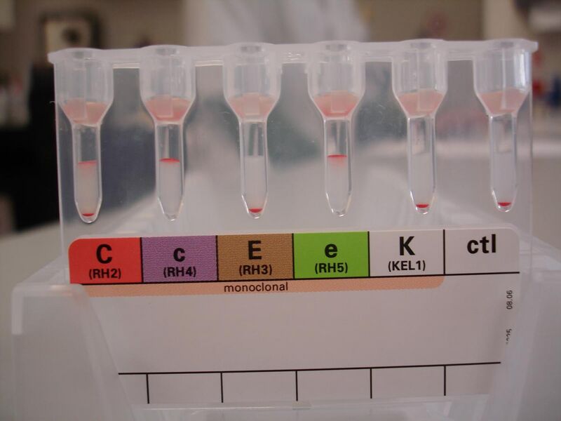 File:Kell and extended Rh antigen blood typing.jpg