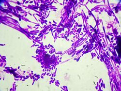 Gram stain of "Candida dubliniensis" cells (1000-fold magnification)