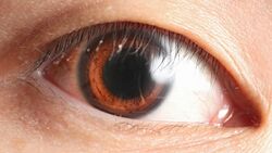Human eye, anterior view.jpg