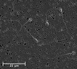 Spermatozoa-human-1000x.jpg