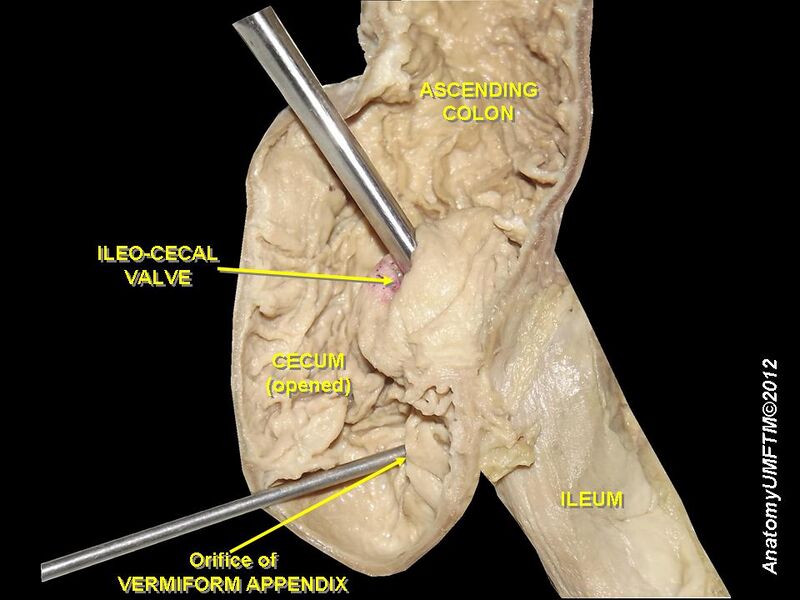 File:Ileo-cecal valve.JPG