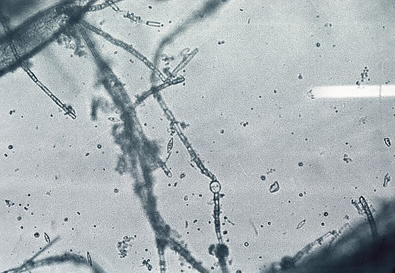 File:Cyanobacteria growing as epiphytes on Chara species.jpg