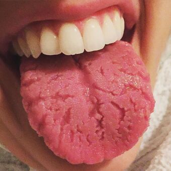 Fissured Tongue.JPG
