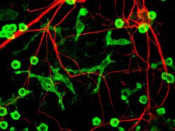 Microglia(green) interacting with neurons(red).