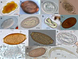 Parasite140080-fig3 Gastrointestinal parasites in seven primates of the Taï National Park - Helminths.png