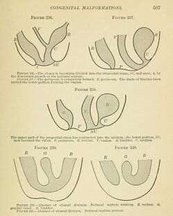 The Principles and practice of gynecology - for students and practitioners (1904) (14581562657).jpg