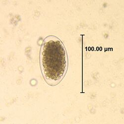 Trichostrongylus egg wtmt HB1.jpg
