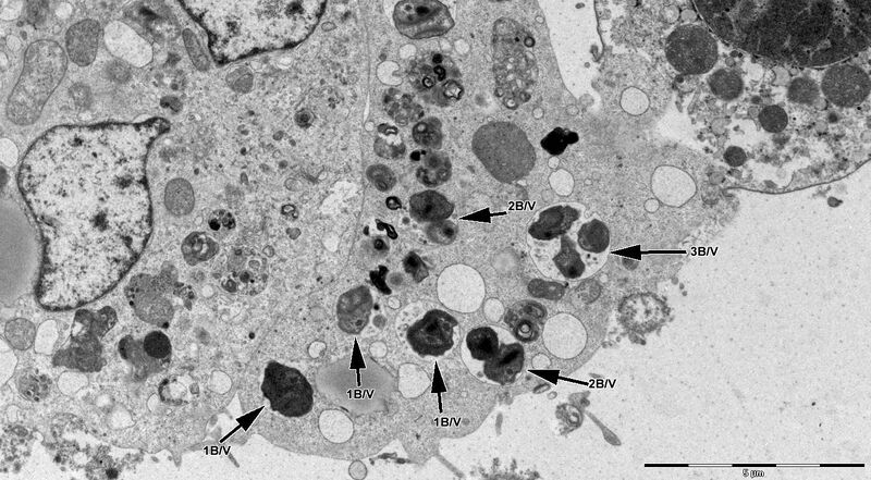 File:Diplorickettsia massiliensis Strain 20B bacteria grown in XTC-2 cells.jpg