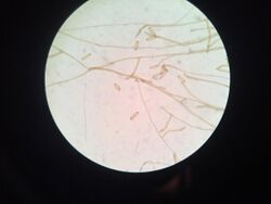 Drechslera under a microscope