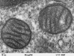 Mitochondria, mammalian lung - TEM.jpg