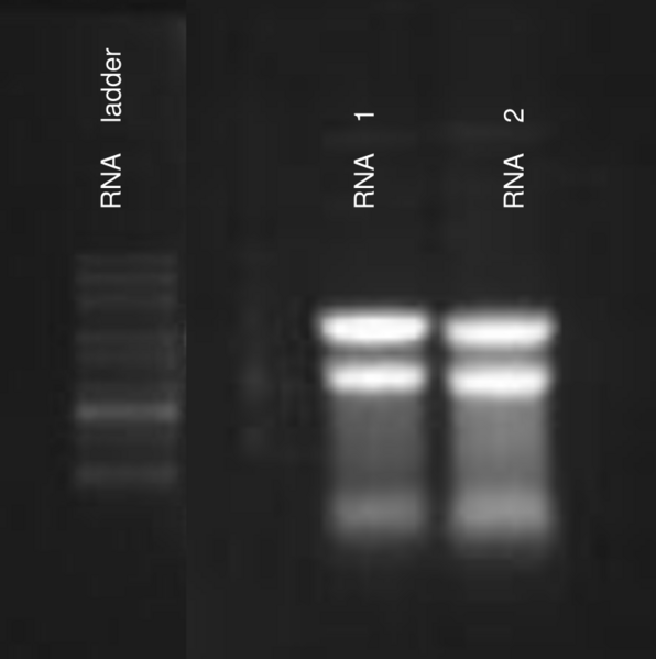 File:RNA agarose gel.svg