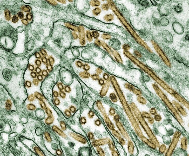 File:Colorized transmission electron micrograph of Avian influenza A H5N1 viruses.jpg