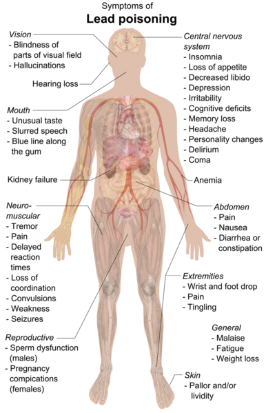 File:Symptoms of lead poisoning (raster).png