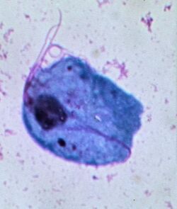 Trichomonas May-Grünwald staining.jpg