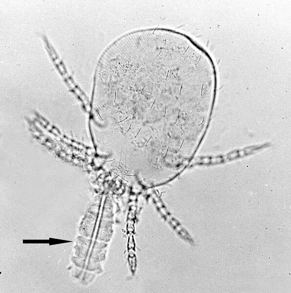 File:Trombicula-larva-stylostome.jpg