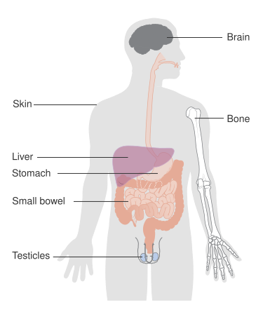 File:DIagram showing where lymphoma can spread in the body CRUK 382.svg