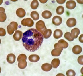 Eosinophil blood smear.JPG