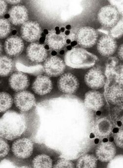 Rotavirus with gold- labelled monoclonal antibody.jpg