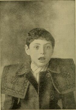1911 photograph of mouth breathing child