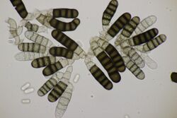 Thielaviopsis basicola chlamydospores 13.jpg
