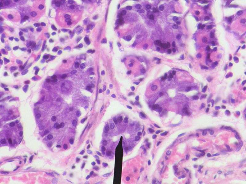 File:Chief cells.JPG