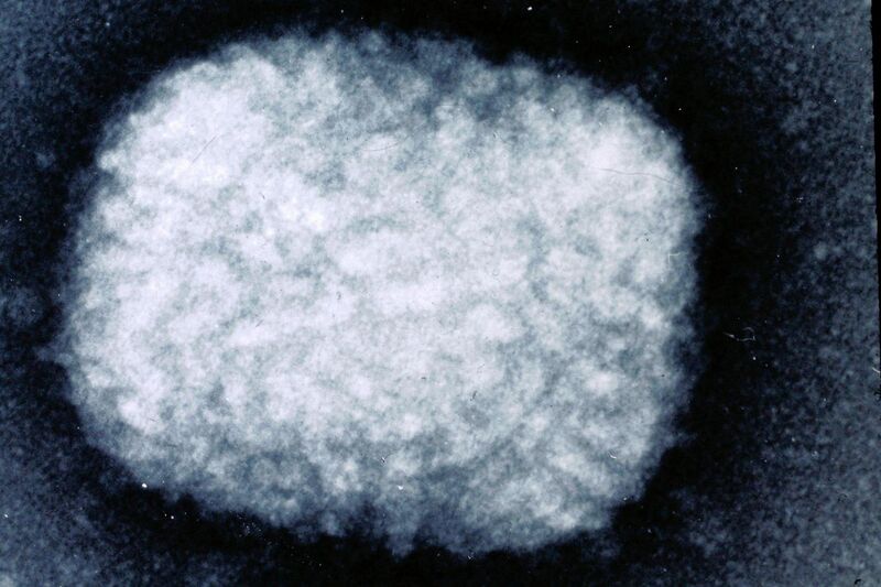 File:Electron micrograph of smallpox virus.jpg