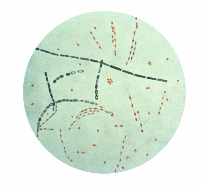File:Bacillus anthracis.png