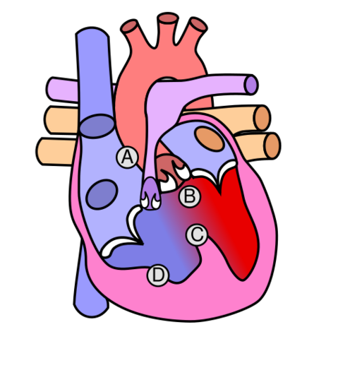 File:Heart tetralogy fallot.svg