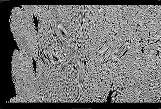 Micro-CT braided polymer rope 2D lateral view 2.jpg