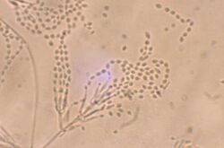 Paecilomyces lilacinus.jpg