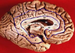 Human brain inferior-medial view description 3.JPG